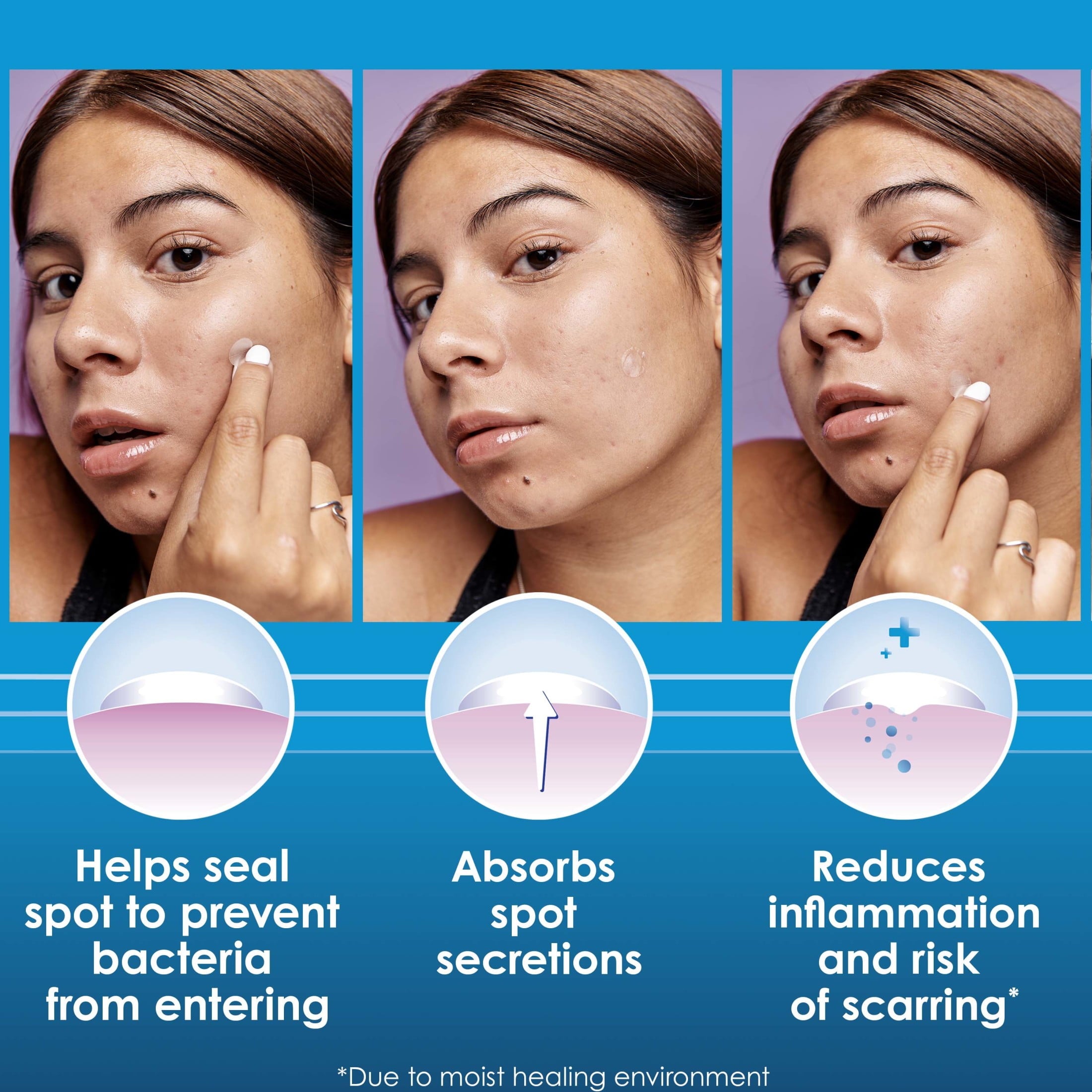Clearasil Ultra Overnight Acne Spot Patches, 18 count