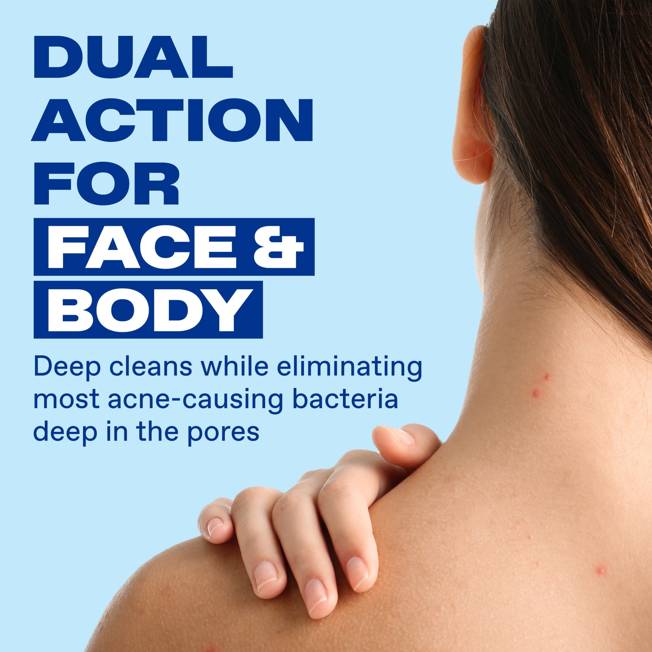 Differin Maximum Strength Acne Foaming Cleanser Face and Body Wash with 10% Benzoyl Peroxide, Fast-Acting Acne Treatment, 5 fl oz